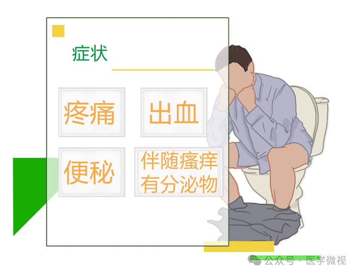 节后肛门喊痛你可能中了它的招