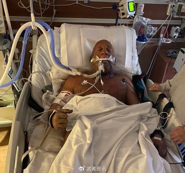 ufc名人堂成员马克·科尔曼火灾中救出父母后因吸入烟雾住院|科尔曼