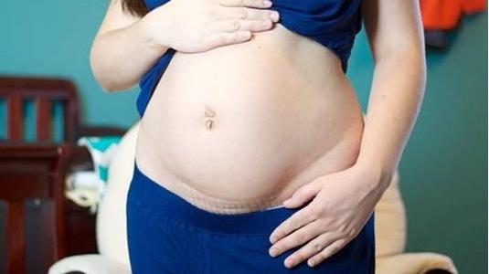 孕妇剖腹产如何让腹部恢复平坦？聪明孕妇这样做