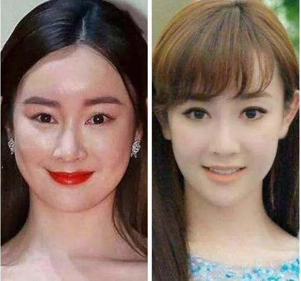 整容失败的艺人，有人成异形美羊羊，有人无戏可拍，有人直播带货