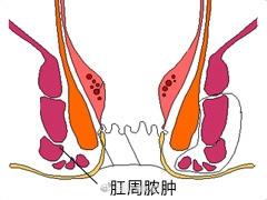 小的變為範圍大的,增加了手術難度,增加了患者痛苦,延長了癒合時間等