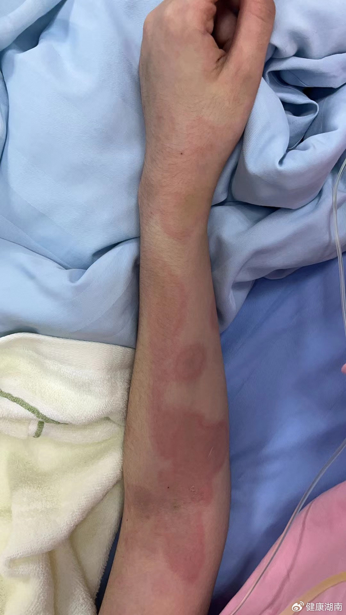 关于地坛医院检查陪护加挂号突发状况第一时间响应,不耽误病情的信息 关于地坛医院检查陪护加挂号突发状况第一时间响应,不耽误病情的信息