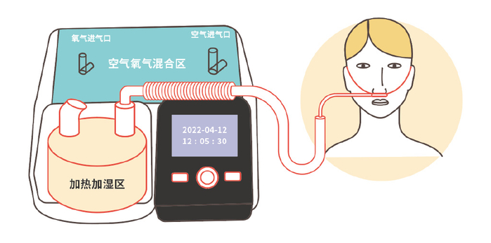 氧疗三问：慢阻肺如何选择适合自己的氧疗方式？