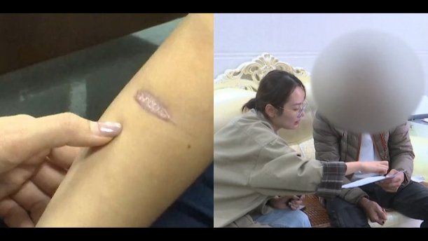 10岁娃满身伤痕！父亲：不听话就棍棒教育，母亲愿抚养遭拒绝
