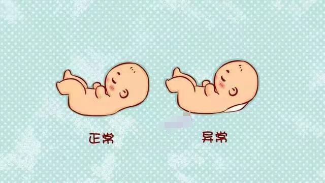 不超过这个"界限"就可以了!|孕妈_新浪新闻