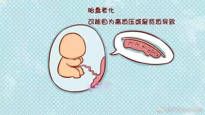 胎盘可以拦截一切病毒？B超单上的胎盘成熟度说明啥？一篇讲清楚