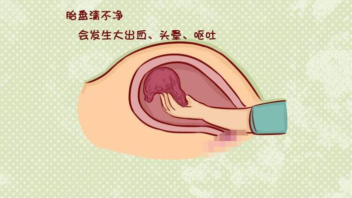 这5类孕妈，分娩时很容易遭遇“手剥胎盘”，比生娃疼100倍！