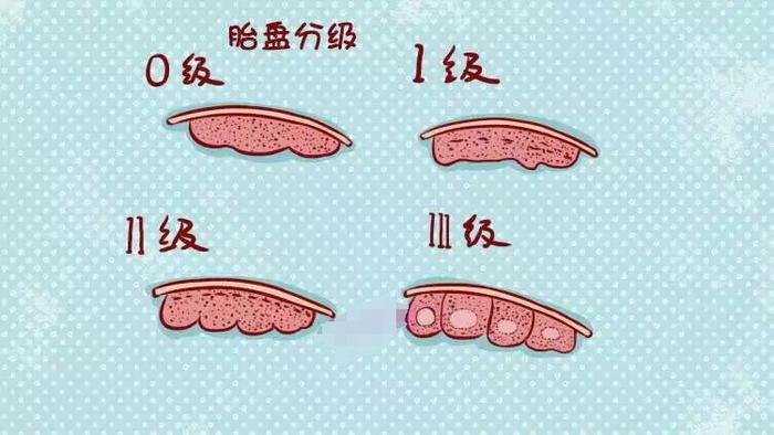 带胎盘出生的图片图片