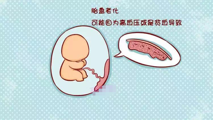 各位孕妈心里一定要有杆秤|胎盘|分娩|孕妈_新浪新闻
