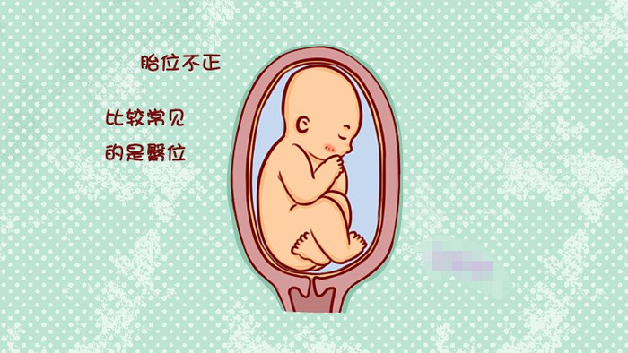 到了这个孕周,胎儿的“胎位”基本固定,以后再等着纠正就难了!