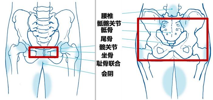 骨盆=骨盆倾斜导致脊柱侧弯 能矫正过来吗
