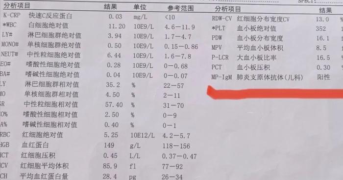 現在檢查肺炎支原體抗體,可以通過血常規一起化驗,物美價廉,但是特異