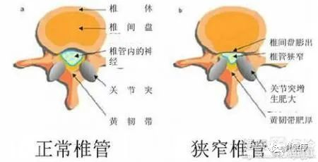 《腰椎使用说明书》,六要六不要|腰椎使用说明书