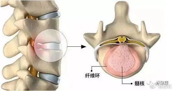 《腰椎使用说明书》