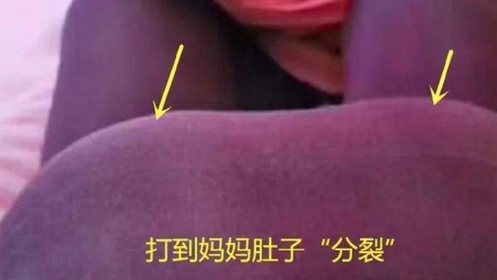 双胞胎也会打架？孕妈做检查时突然腹痛，B超显示俩娃正拳打脚踢
