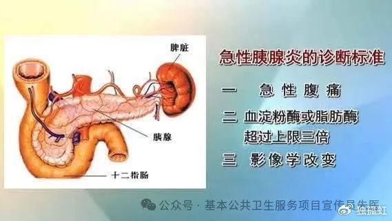 基层医生值班必看,各种急救方法全了|急性胰腺炎|药物|硝酸甘油_新浪