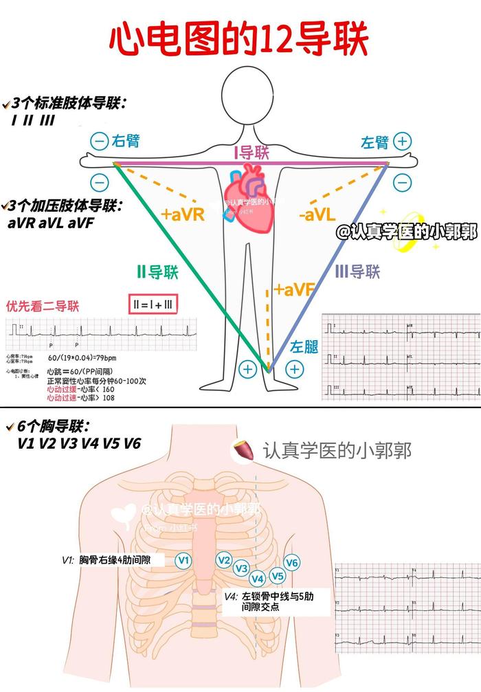 心电图位置顺序图片