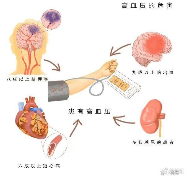 高血压生活管理指南,涉及方方面面!