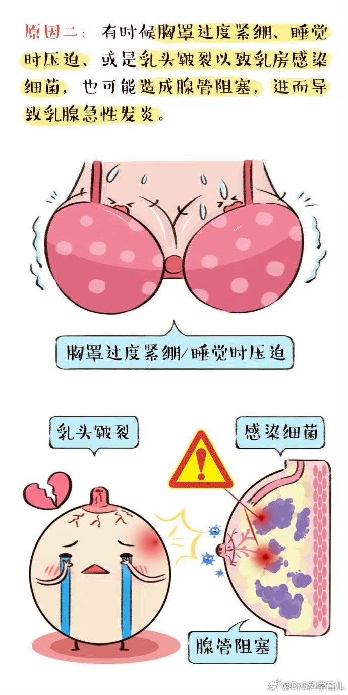 哺乳期得了乳腺炎怎么办?