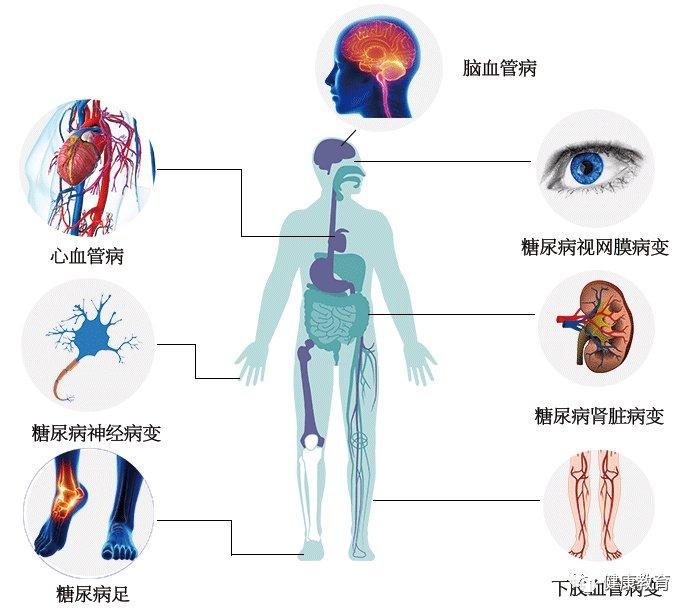 病变,糖尿病眼病,糖尿病足,糖尿病肾病,冠心病,缺血性或出血性脑血管