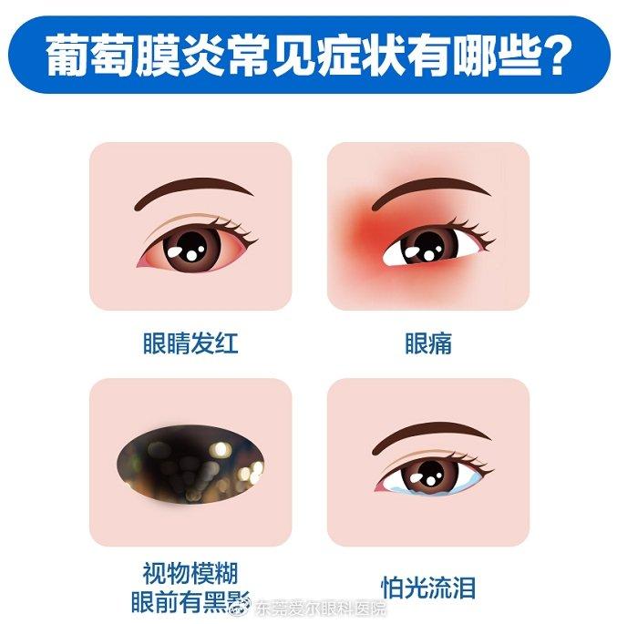 红眼病怎么治疗最快好图片