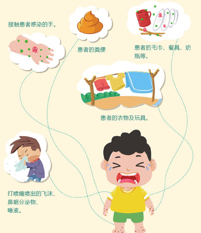 手足口病莫大意,一讲卫生二疫苗|手足口病|病毒|肠道_新浪新闻