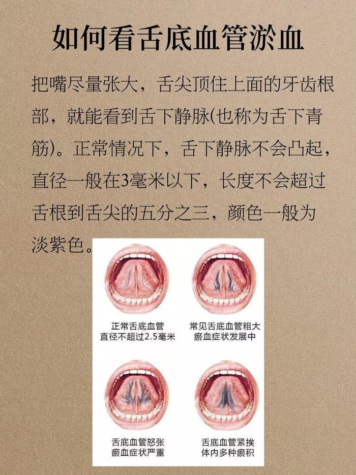 舌头上有斑点斑块图片图片