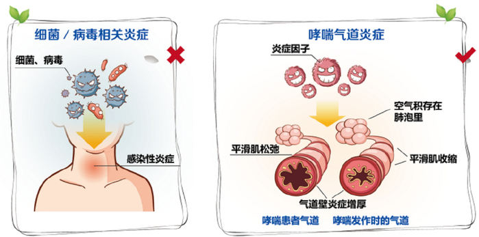 哮喘诊断方法大全 如何检查是否患上哮喘