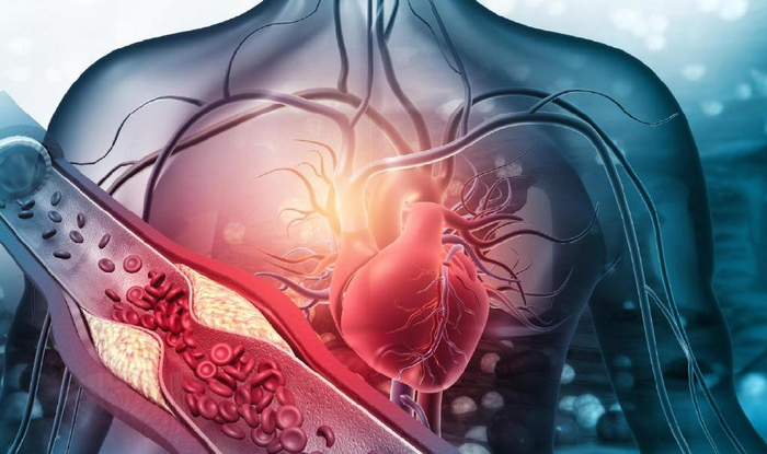 很多人对此,存在误解|冠心病|心电图|心肌缺血_新浪新闻