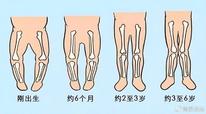 99寶寶過早站立和跳蹦,危害不能忽視