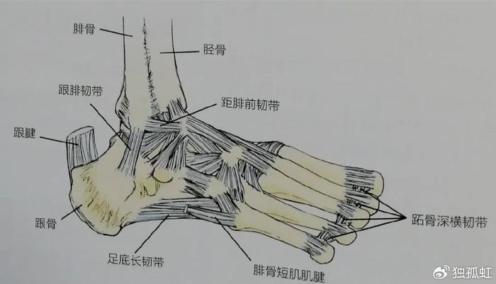 急性踝关节扭伤不要冰敷