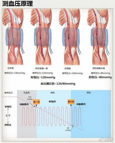 15张高血压医学美图,一文搞定高血压!|血管|截面积|示意图|肾素|醛固酮_新浪新闻