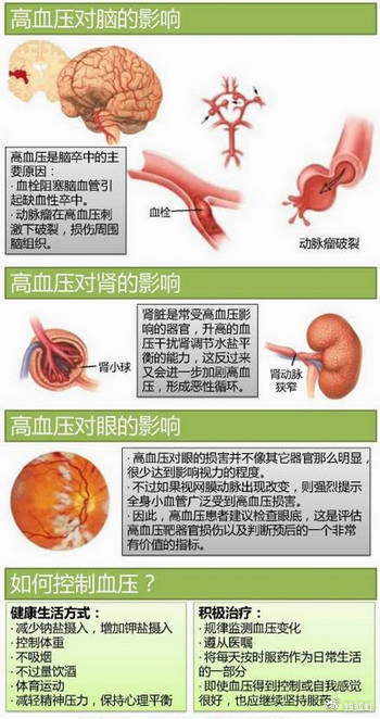 15张高血压医学美图,一文搞定高血压!|高血压|美图|血压