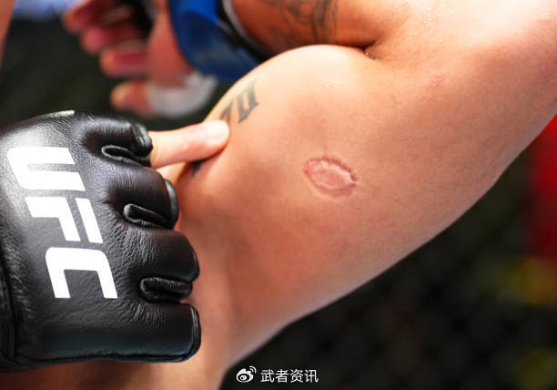 娜玛尤纳斯一致判定战胜里巴斯,不败新秀遭犯规被咬出