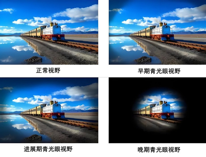 看图自查"视"界——关注眼健康,共享清晰"视"界