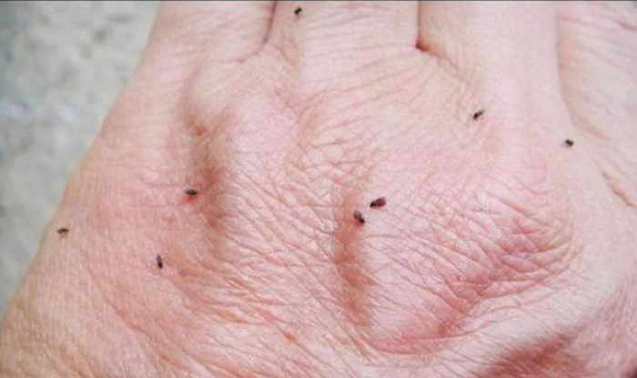 这些"小黑点"咬人比蚊子厉害 ——科学预防蠓叮咬