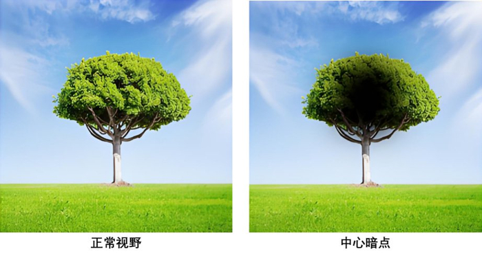 看图自查"视"界——关注眼健康,共享清晰"视"界|视力|青少年|高度近视