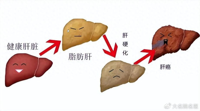 肝脏脂肪有多少?磁共振脂肪定量分析技术"温柔"告诉你