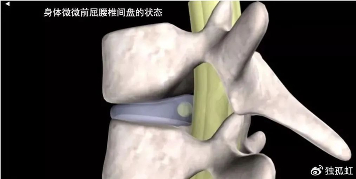 腰椎间盘突出千万不能做这个动作|仰卧起坐|腰椎|腰椎间盘突出_新浪新