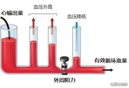15张高血压医学美图,一文搞定高血压!|血管|截面积|示意图|肾素|醛固酮_新浪新闻