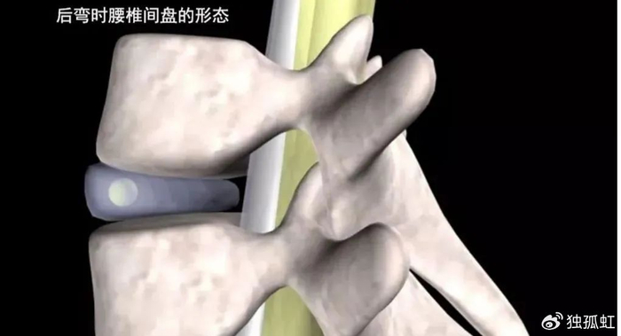 腰椎间盘突出千万不能做这个动作|仰卧起坐|腰椎|腰椎间盘突出_新浪新