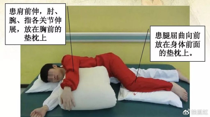 图解脑卒中康复运动功能训练|运动功能障碍|侧卧位|版权|双桥|步行_新浪新闻