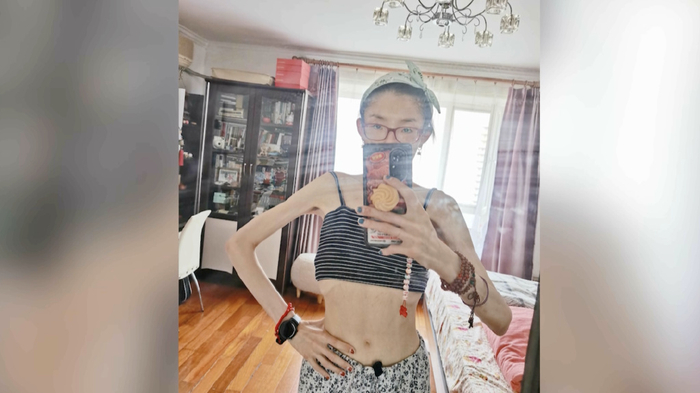 从210斤到不足70斤,一个花季少女的"复仇"|母亲|厌食症|张紫初_新浪