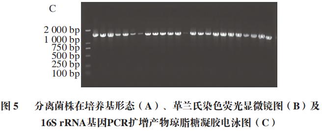 經革蘭氏染色檢驗(圖5b),為紫色球形,鏈球,長杆