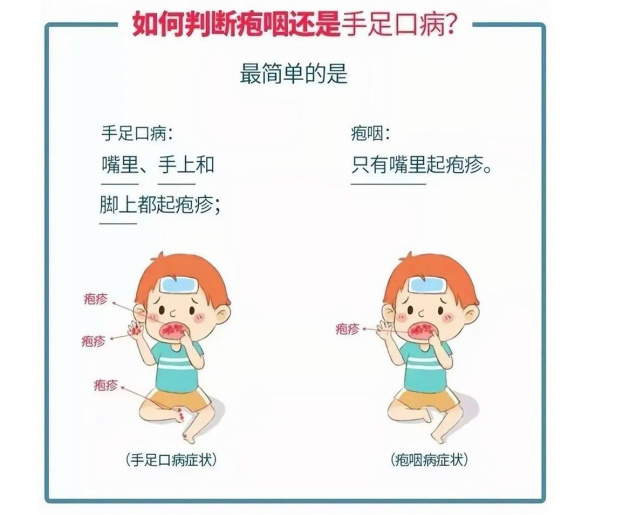 手足口病&疱疹性咽峡炎来袭,预防要点看这里