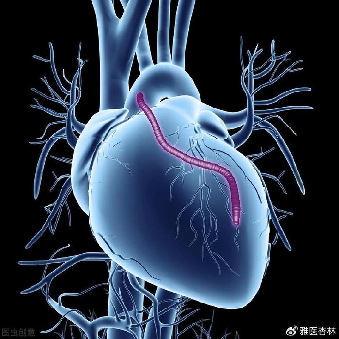 心衰症状图片图片