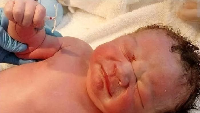 最霸气婴儿：妈妈戴节育环还怀孕，孩子拽环出生：我命由我不由天