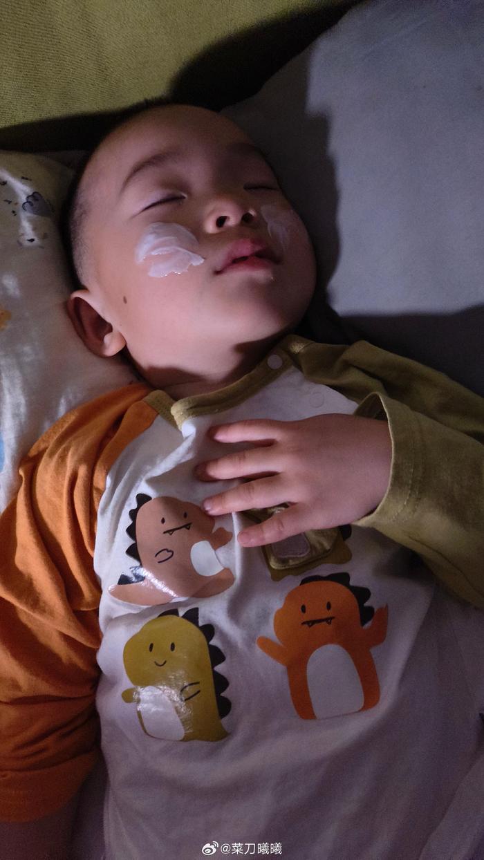 大风把孩子脸吹皴了， 只能这样抹油，因为白天不让抹