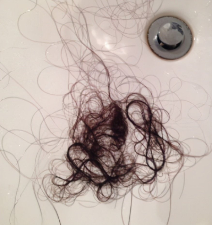 产后掉头发,一抓一把,5个问题了解产后脱发,教新妈妈如何预防|脱发|头