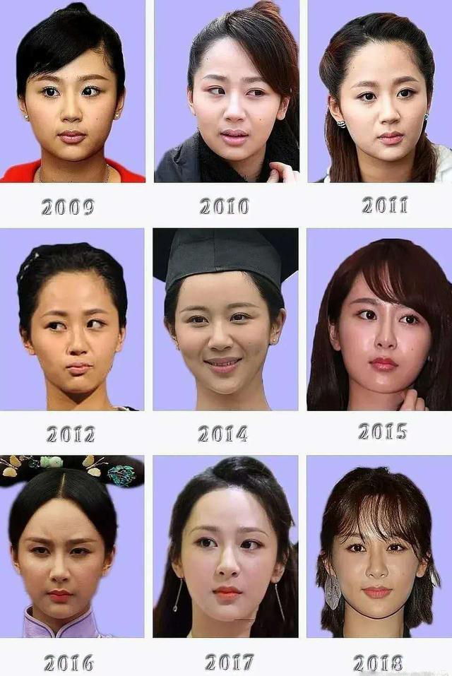 真的整容了？杨紫过去10年正脸照对比，看看她容貌变化究竟有多大
